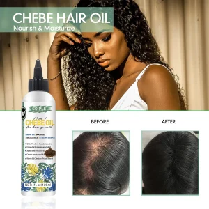 Fast Hair Growth Chebe Oil - Repair Damaged Scalp & Anti-Hair Loss